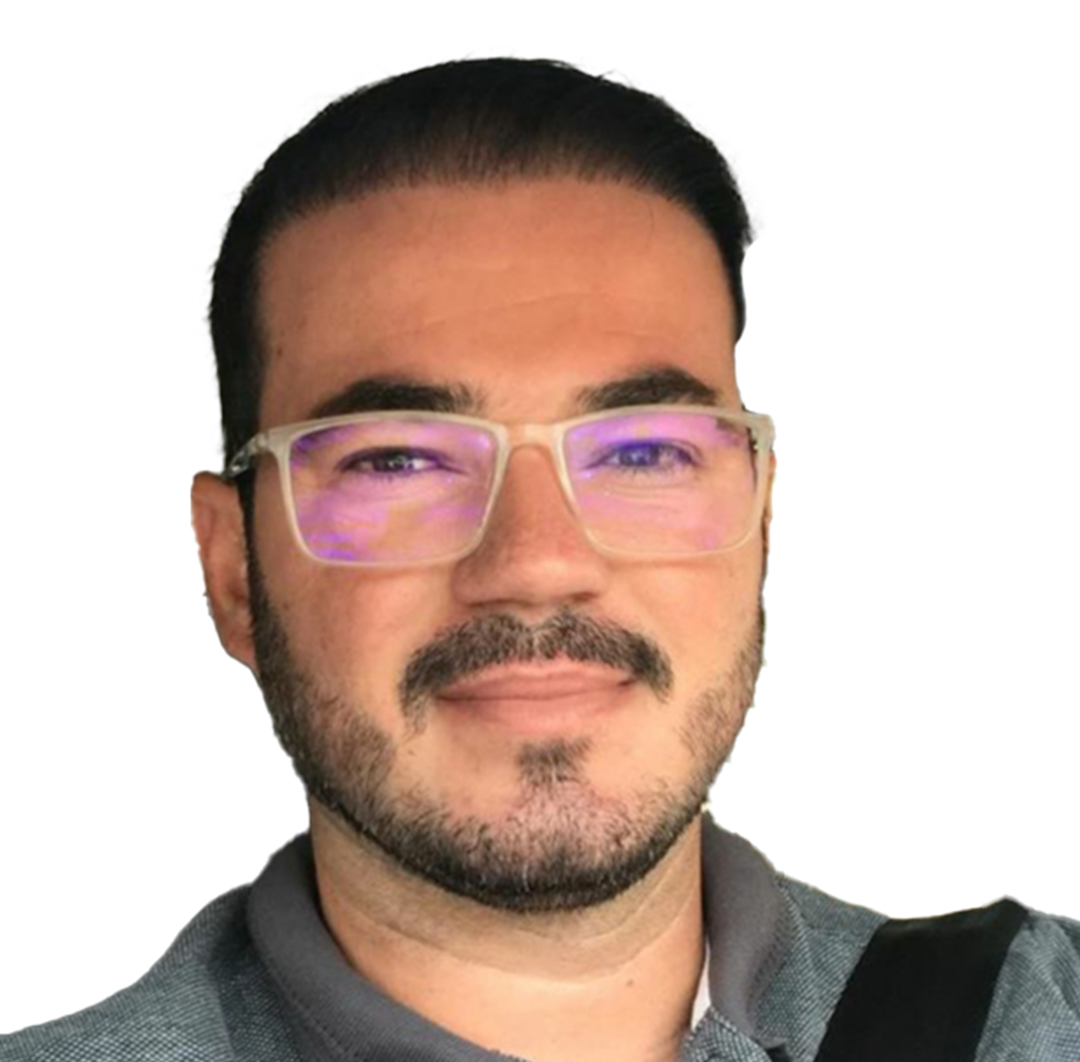 Hair Transplant in Turkey - After Procedure - Customer Photo