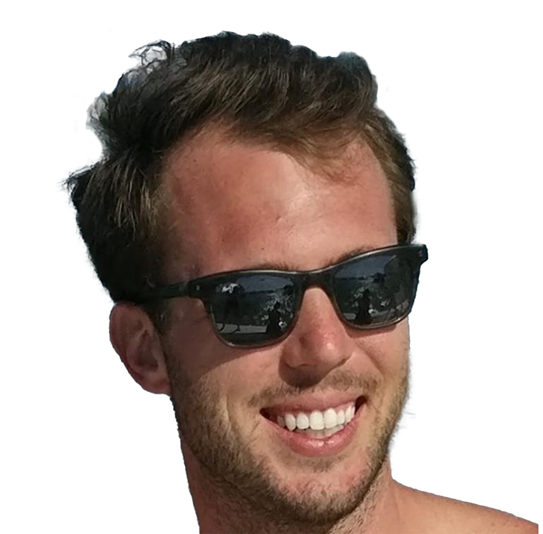 Hair Transplant in Turkey - After Procedure - Customer Photo