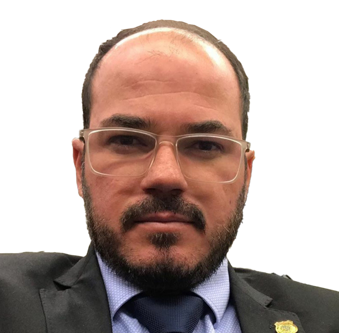 Hair Transplant in Turkey - Before Procedure - Customer Photo